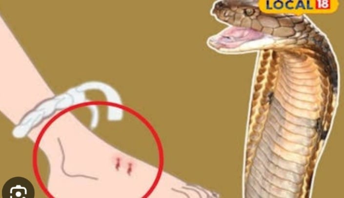Rainy season and snakebite: Awareness and timely medical treatment is the only protection