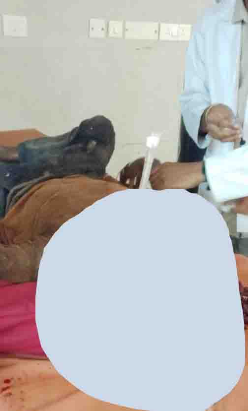 The life of a young man with a cut throat was saved – ENT surgeon Dr. Amit Singh's team performed a difficult operation